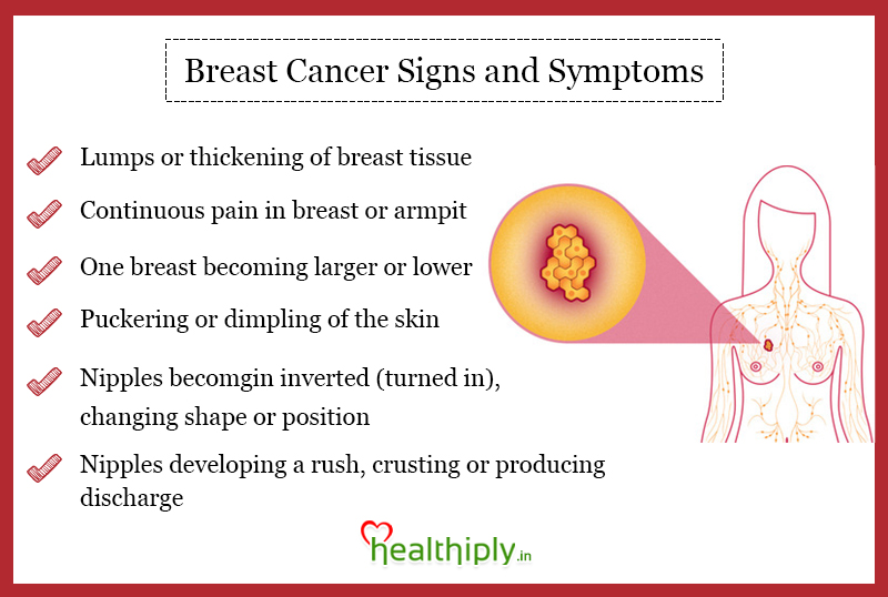 Breast Cancer Signs And Symptoms Healthiply
